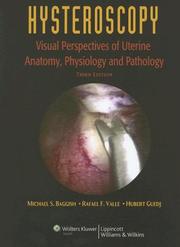 Cover of: Hysteroscopy by Michael S. Baggish, Rafael F. Valle, Hubert Guedj