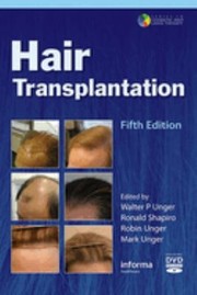 Cover of: Hair Transplantation