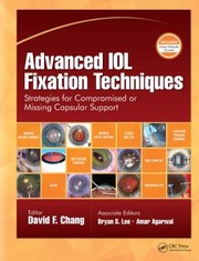 Cover of: Advanced IOL Fixation Techniques: Strategies for Compromised or Missing Capsular Support