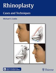 Rhinoplasty by Michael S. Godin