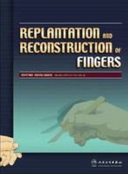 Cover of: Replantation and Reconstruction of Fingers