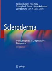 Cover of: Scleroderma: From Pathogenesis to Comprehensive Management