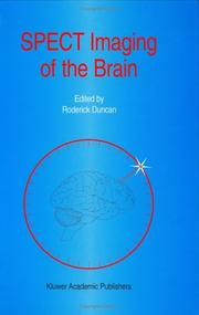 Cover of: SPECT imaging of the brain by edited by Roderick Duncan.