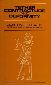 Cover of: Tether, Contracture and Deformity by John Mounsten Pemberton Clark, John Mounsten Pemberton Clark