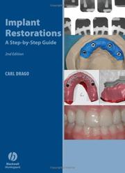 Cover of: Implant Restoration Solutions: A Step-by-Step Guide