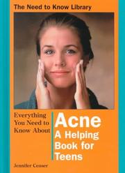 Cover of: Everything You Need to Know About Acne: A Helping Book for Teens (Need to Know Library)