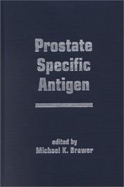 Cover of: Prostate Specific Antigen