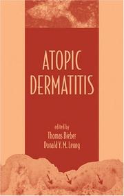 Cover of: Atopic Dermatitis by 