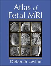 Cover of: Atlas of Fetal MRI