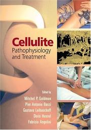 Cover of: Cellulite by edited by Mitchel P. Goldman ... [et al.].
