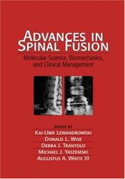 Cover of: Advances in Spinal Fusion: Molecular Science, BioMechanics, and Clinical Management