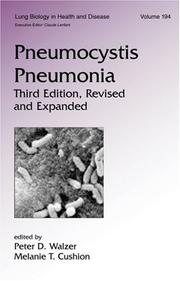 Pneumocystis pneumonia