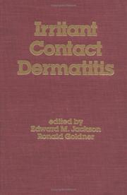 Cover of: Irritant contact dermatitis