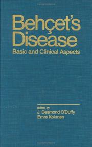 Behçet's disease