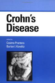 Cover of: Crohn's disease