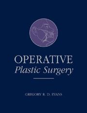 Cover of: Operative Plastic Surgery