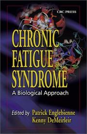 Cover of: Chronic Fatigue Syndrome by 
