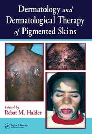 Cover of: Dermatology and Dermatological Therapy of Pigmented Skins