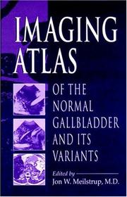Cover of: Imaging atlas of the normal gallbladder and its variants by edited by Jon W. Meilstrup.