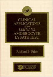 Clinical applications of the Limulus amoebocyte lysate test