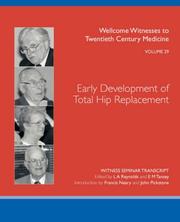 Cover of: Early Development of Total Hip Replacement by 