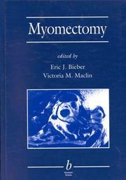 Cover of: Myomectomy