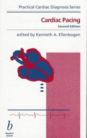 Cover of: Cardiac pacing