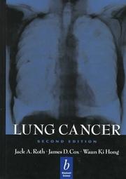 Cover of: Lung cancer