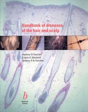 Handbook of diseases of the hair and scalp by Rodney D. Sinclair