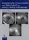 Cover of: Endoscopic Evaluation and Treatment of Swallowing Disorders