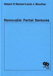 Cover of: Removable partial dentures