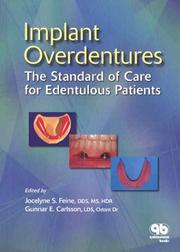 Cover of: Implant Overdentures: The Standard of Care for Edentulous Patients
