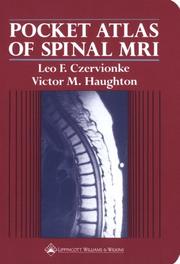 Pocket atlas of spinal MRI by Leo F. Czervionke, Victor M. Haughton