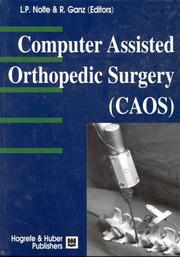 Computer assisted orthopedic surgery (CAOS) by R. Ganz