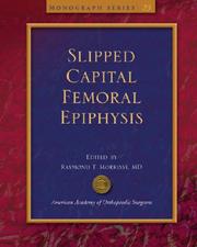 Slipped capital femoral epiphysis by Raymond T. Morrissy