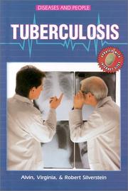 Cover of: Tuberculosis | Alvin Silverstein