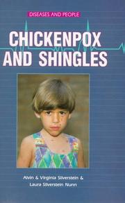 Cover of: Chickenpox and shingles by Alvin Silverstein