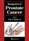 Cover of: Management of Prostate Cancer