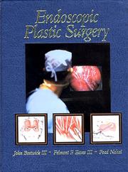 Cover of: Endoscopic plastic surgery by John Bostwick