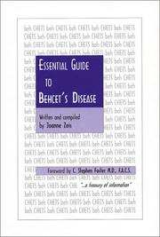 Cover of: Essential Guide to Behcet's Disease by Joanne Zeis