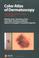 Cover of: Color Atlas of Dermatoscopy