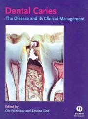 Cover of: Dental Caries: The Disease and Its Clinical Management