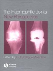 Cover of: The Haemophilic Joints | E. C. Rodriguez-Merchan