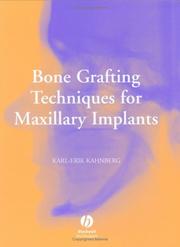 Cover of: Bone Grafting Techniques for Maxillary Implants