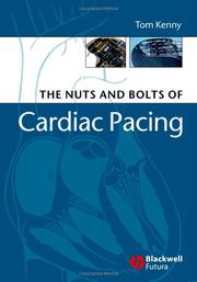 The nuts and bolts of cardiac pacing by Kenny, Tom