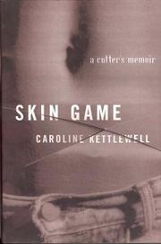 Cover of: Skin Game by Caroline Kettlewell