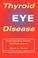 Cover of: Thyroid Eye Disease