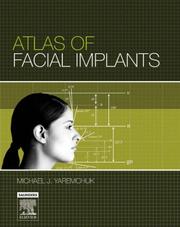 Cover of: Atlas of Facial Implants