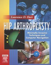 Cover of: Hip Arthroplasty by Lawrence D. Dorr