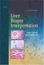 Cover of: Liver Biopsy Interpretation by Peter J. Scheuer, Jay H. Lefkowitch